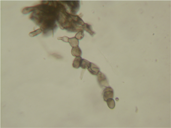  Les spores de champignons sous le microscope